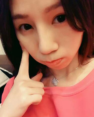 隆鼻整形術(shù)后1-7天的照片 隆鼻整形經(jīng)歷分享