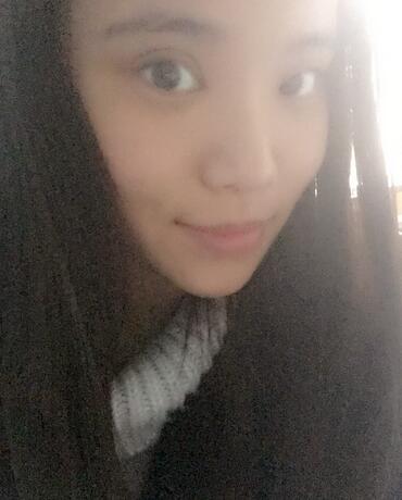 鄭州悅美切開雙眼皮半個(gè)月恢復(fù)日記