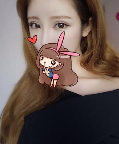 鄭州悅美微創(chuàng)雙眼皮+開(kāi)眼角3個(gè)月