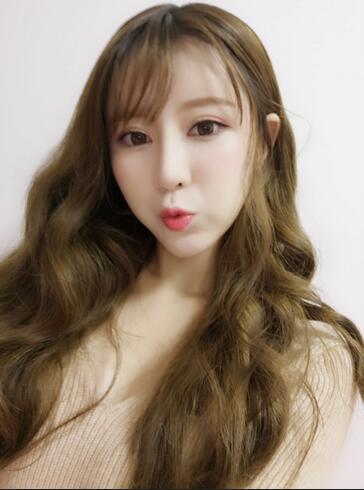 鄭州悅美微創(chuàng)雙眼皮+開(kāi)眼角3個(gè)月