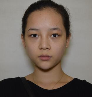 深圳晨曦微創(chuàng)定點(diǎn)每天恢復(fù)圖 美爆了~