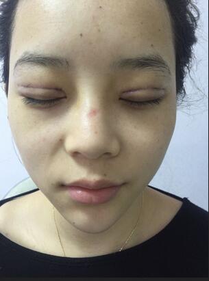 深圳晨曦微創(chuàng)定點(diǎn)每天恢復(fù)圖 美爆了~