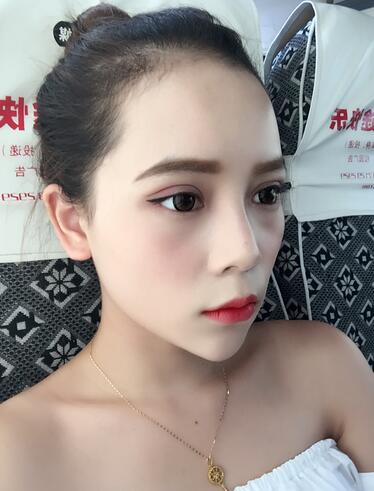 深圳晨曦微創(chuàng)定點(diǎn)每天恢復(fù)圖 美爆了~