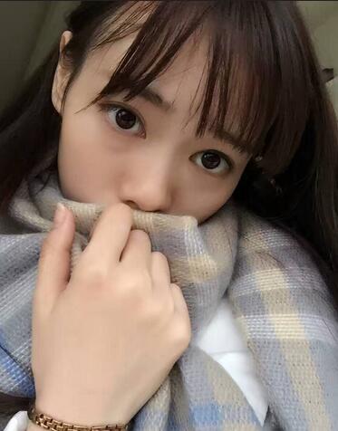 深圳晨曦三點(diǎn)定位雙眼皮日記