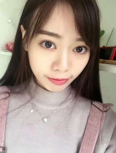 深圳晨曦三點(diǎn)定位雙眼皮日記