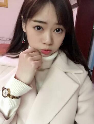 深圳晨曦三點(diǎn)定位雙眼皮日記