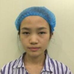 自體脂肪填充后十天圖