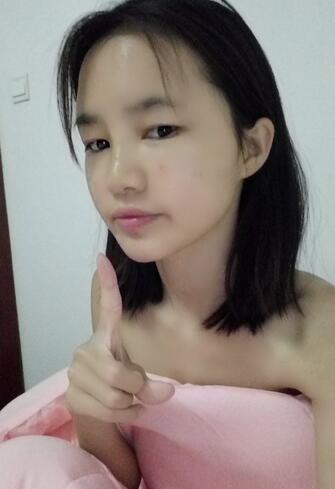 自體脂肪填充后十天圖