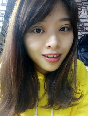 北京熙朵全切雙眼皮1個(gè)月恢復(fù)日記