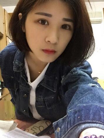 微創(chuàng)定點每天恢復過程圖 北京麗星雙眼皮3個月