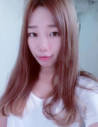 硅膠隆鼻恢復(fù)日記 硅膠隆鼻+鼻小柱延長(zhǎng)+墊鼻尖