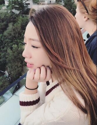 硅膠隆鼻恢復(fù)日記 硅膠隆鼻+鼻小柱延長(zhǎng)+墊鼻尖