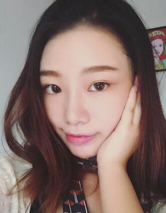 硅膠隆鼻恢復(fù)日記 硅膠隆鼻+鼻小柱延長(zhǎng)+墊鼻尖