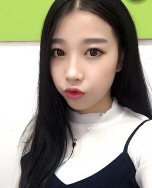 全割雙眼皮恢復日記 全切雙眼皮+開眼角