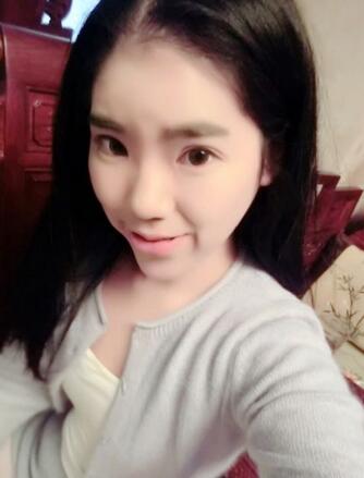 隆鼻整形2個月恢復日記 硅膠隆鼻+鼻翼縮小