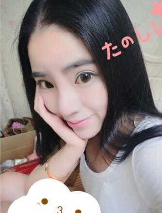 隆鼻整形2個月恢復日記 硅膠隆鼻+鼻翼縮小