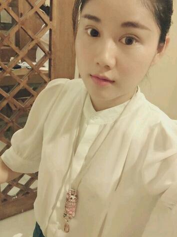 全切雙眼皮半年恢復過程圖