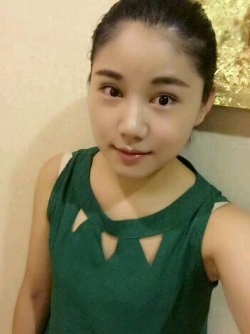 全切雙眼皮半年恢復過程圖