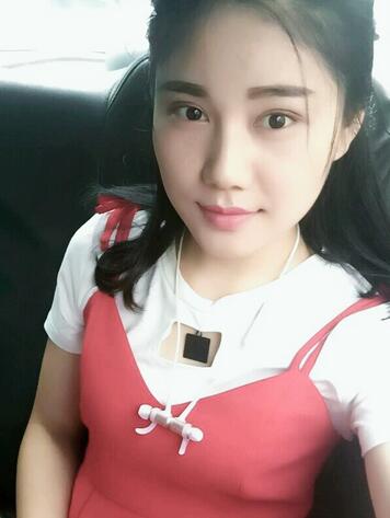 全切雙眼皮半年恢復過程圖