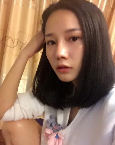 隆鼻整形真實恢經(jīng)歷 曬圖啦!