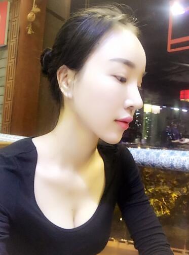 鼻修復(fù)后的恢復(fù)期經(jīng)歷分享