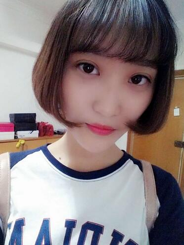 切開雙眼皮恢復(fù)全過程