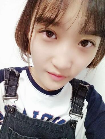 切開雙眼皮恢復(fù)全過程