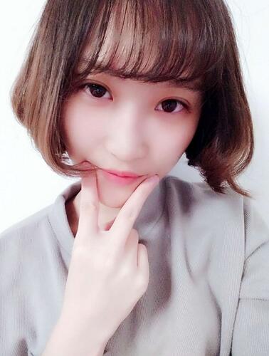 切開雙眼皮恢復(fù)全過程