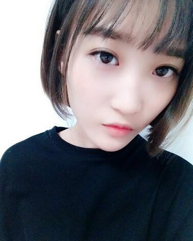 切開雙眼皮恢復(fù)全過程