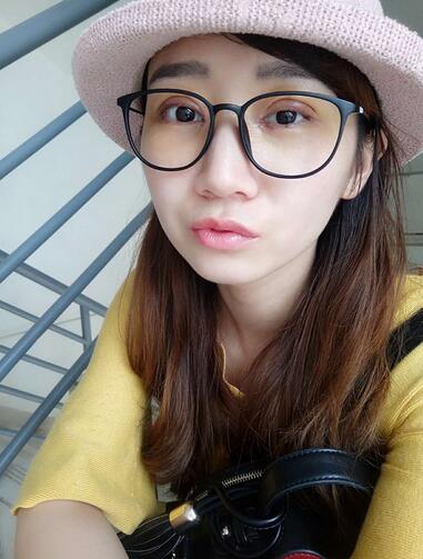 上海九院林曉曦割雙眼皮半年了