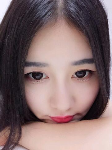 北京八大處范飛隆鼻整形案例