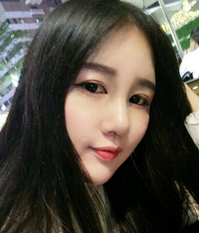 北京八大處范飛隆鼻整形案例