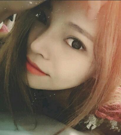隆鼻整形真實恢復(fù)期圖片 杭州東方隆鼻整形四個月