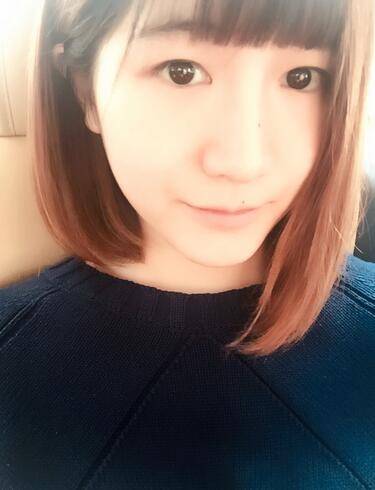 杭州王圣林全切雙眼皮恢復過程圖