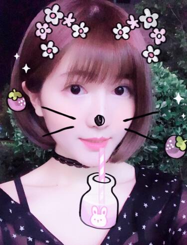 杭州王圣林全切雙眼皮恢復過程圖