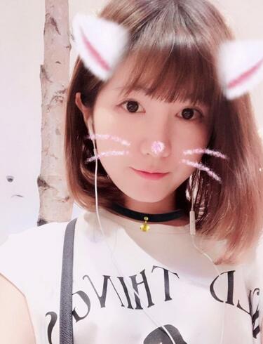 杭州王圣林全切雙眼皮恢復過程圖