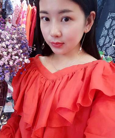 北京八大處辛敏強做雙眼皮怎么樣 案例分享