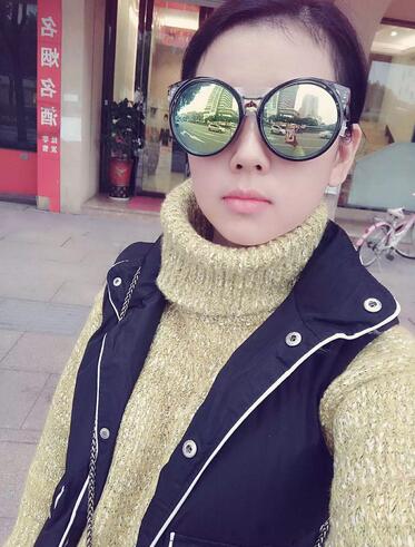 北京八大處辛敏強做雙眼皮怎么樣 案例分享