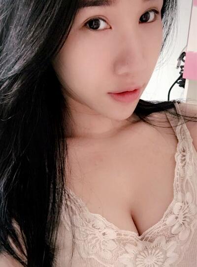 自體脂肪隆胸一個(gè)月后 北京葉子做的