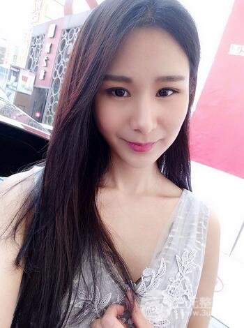 芭比雙眼皮多項(xiàng)整形前后對(duì)比照片 青島諾德曹繼武雙眼皮案例