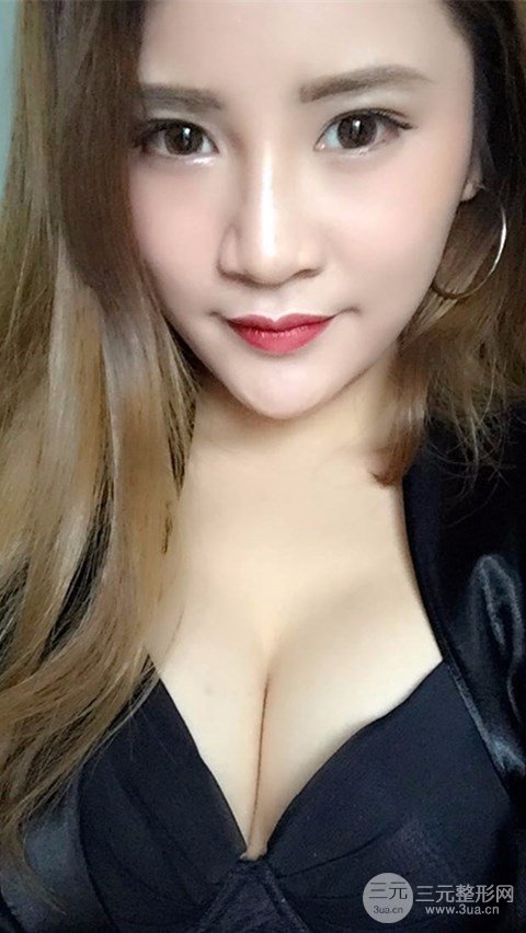 淄博陽(yáng)光整形自體脂肪隆胸前后對(duì)比圖，真實(shí)案例