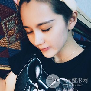 隆鼻整形多少錢 南京克拉美隆鼻整形案例