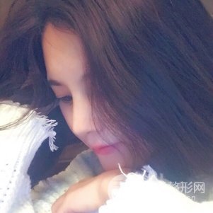 隆鼻整形多少錢 南京克拉美隆鼻整形案例