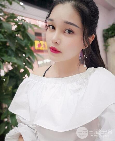 鼻頭縮小術(shù)過(guò)程圖，鼻頭縮小恢復(fù)日記