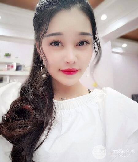 鼻頭縮小術(shù)過(guò)程圖，鼻頭縮小恢復(fù)日記