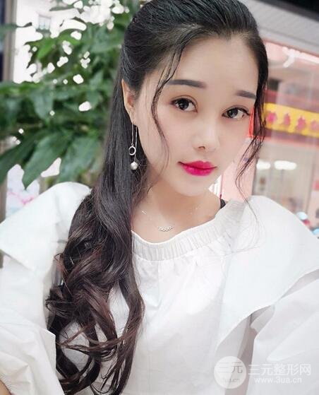 鼻頭縮小術(shù)過(guò)程圖，鼻頭縮小恢復(fù)日記