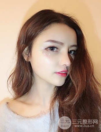 全臉自體脂肪填充+隆鼻整形果永.久保持、丑小鴨變天鵝不是夢(mèng)