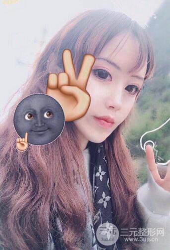 自體脂肪填充全臉基本換臉，改臉型不只是磨骨才能做到！