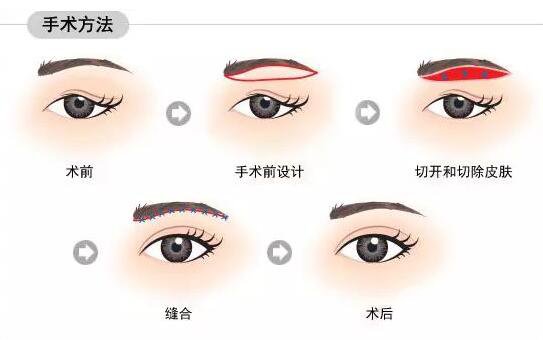 切眉
