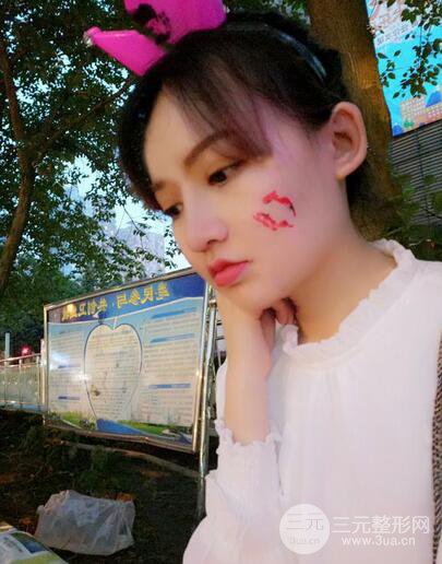 耳軟骨隆鼻全過程及術(shù)后果分享